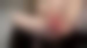 anorexic prolapse pussy ai porn|Thighs That Have Been Tightened To The Point Of Deformity, Severe Prolapse  Of The Anus, Metal