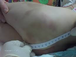 hymen child|Virginity + Hymen types and causes of Hymen rupture - YouTube