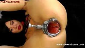 Speculum porn videos jpg x Vaginal speculum