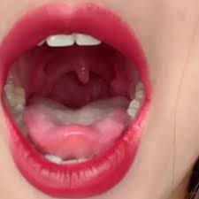 My tender uvula fetish close up lpvi jpg x Uvula fetish