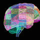 Test Of Experimental Alzheimer's Drug Finds Progress Against Brain Plaques 