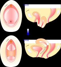 子宮脱|骨盤臓器脱｜婦人科｜北海道医療センター