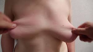 Denise nipple pulling machine jpg x Nipple pulling