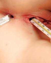 Thermometer anal rectal jpg x Thermometer anal rectal