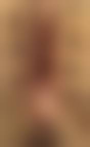  child labia hymen|Interpretation of Medical Findings in Suspected Child Sexual Abuse: An  Update for 2018 - ScienceDirect