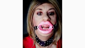 Bondage slut with open mouth harness gag jpg x Open mouth gag