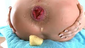 Roxy raye prolapse jpg x Roxy raye prolapse
