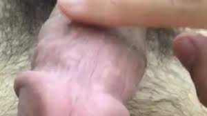 Foreskin cum jpg x Foreskin cum