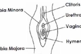child hymen |a) Semilunar hymen. (b) Cribriform hymen. (c) Septate hymen. (d)... |  Download Scientific Diagram