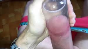 Extreme penis pump gone wrong jpg x Extreme penis pumping