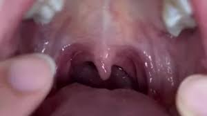 Free uvula fetish porn videos from thumbzilla jpg x Uvula fetish