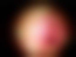 prepubertAL VAGINA|Genital Examination of the Prepubertal Female: Essentials for Pediatric  Nurse Practitioners - Journal of Pediatric Health Care