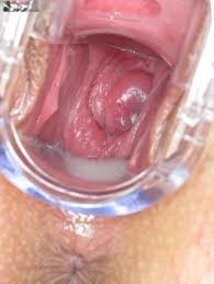 Vaginal speculum jpg x Vaginal speculum