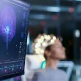 EEG Imaging System market will reach at $ 34.76 billion by 2032, key players- Nihon Kohden, NCC Medical ...