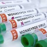 ICMR isolates monkeypox virus; invites firms to develop vaccines