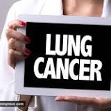 The lung cancer symptoms NHS is urging people not to ignore