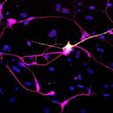 Aged neurons generated directly from skin more accurately model Parkinson's disease