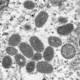 Monkeypox Outbreak: Smallpox Vaccine Maker SIGA Technologies Inc. (SIGA) on a Bullish Roll