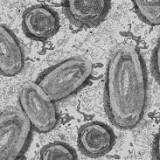 Monkeypox case found in Mecklenburg County