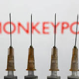 LA County confirms 1st presumptive case of monkeypox