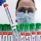Abbott developing test for monkeypox -Breaking