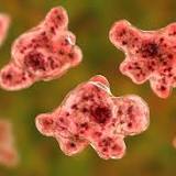 Brain-Eating Amoeba: Assume There's A Risk In Warm Calif. Lakes
