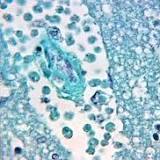 Brain-Eating Amoeba Suspected In Second Midwest Death