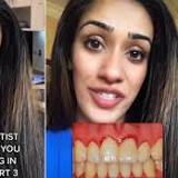 The gums don't lie! Dentist says she can tell patients are PREGNANT just by looking inside their mouths (thanks to this ...