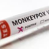 CDC sets up monkeypox emergency command center to ramp up surveillance